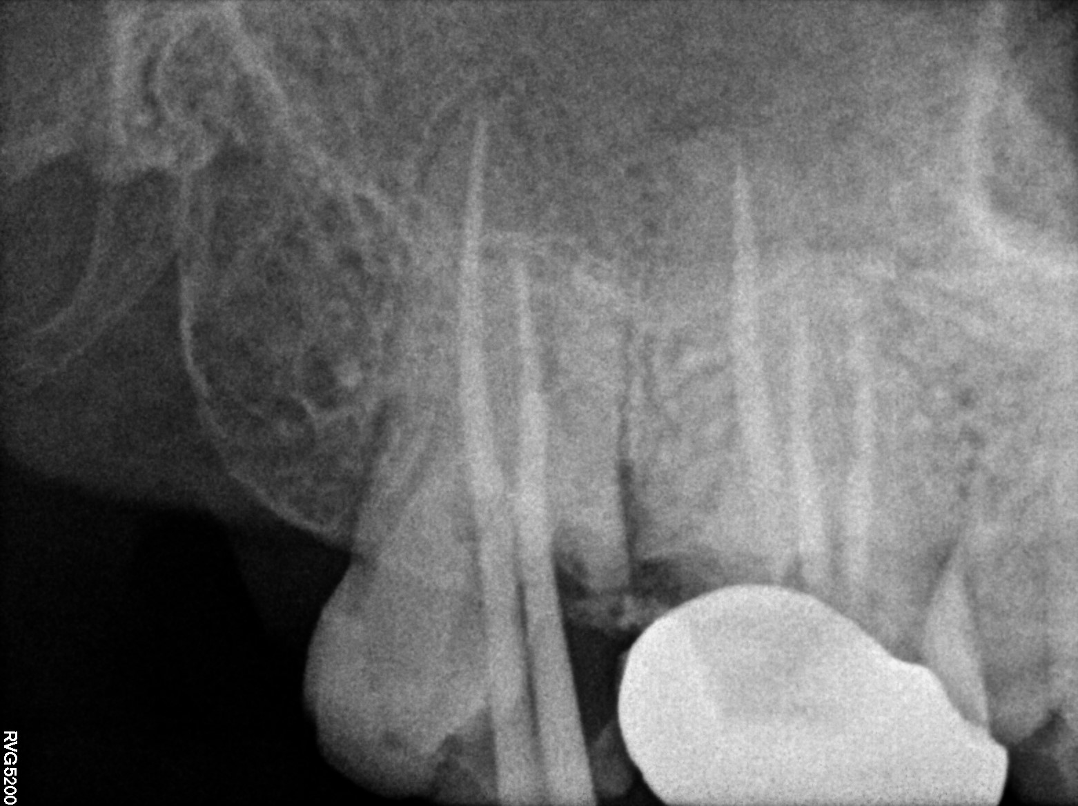 Dental X-ray